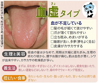 体質チェック - 漢方薬局 開気堂薬局